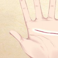 人们的伤疤注定要有一个很好的棕榈疤。