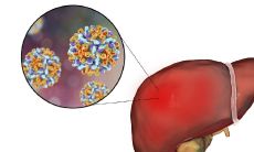 如何通过手相图判断肝胆是否健康?(肝健康与否的手相指引)