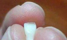 女性做梦上排牙齿全部脱落:探究该梦境在文化意义上的象征意义及其可能代表的个人情感经历和心理状态