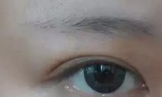 眉毛上长痘痘面相学是什么意思(眉毛缺一块面相)