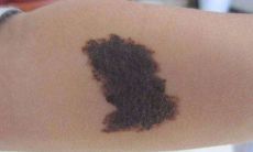 胎记跟前世有关系吗(千万不能唤醒前世记忆)