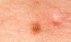 面相里面的水险是什么意思(女人面相痣水险是什么意思)