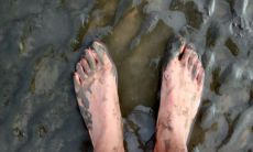 梦见被蛇咬脚了并且出血了(梦见被蛇咬左脚出血了)