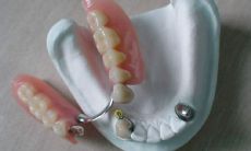 梦见牙齿掉了一大把吐到手上还有血(梦见牙齿掉了并吐一把还吐血)