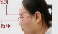 面相的夫妻宫图解(手相夫妻宫在哪里)