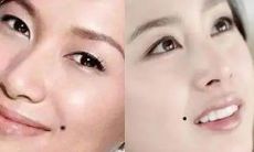 法令纹上长痣面相图解(饭店起名字大全四个字)