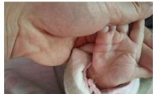 新生儿手相就定下了吗（11种人容易短命的手相）