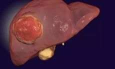 男生黑眼圈面相（女人面相分析）