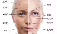 川字纹是否影响风水（眉间川字纹的风水说法）