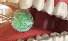 梦见全部牙齿掉落（梦见满口的牙齿脱落）