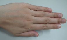 事业线有鱼形纹手相（鱼形纹手相是什么样的）