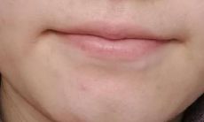 下巴有小窝窝面相（女人下巴中间有个凹陷面相）