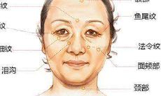 嘴边法令纹像括号面相（笑起来嘴角有括号面相）