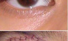 男的上眼皮下垂面相（面相眼角下垂的男人）